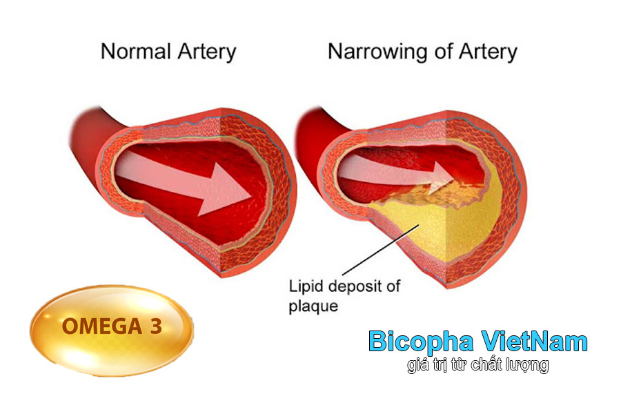 Bệnh mỡ máu bổ sung dầu cá omega 3 được không